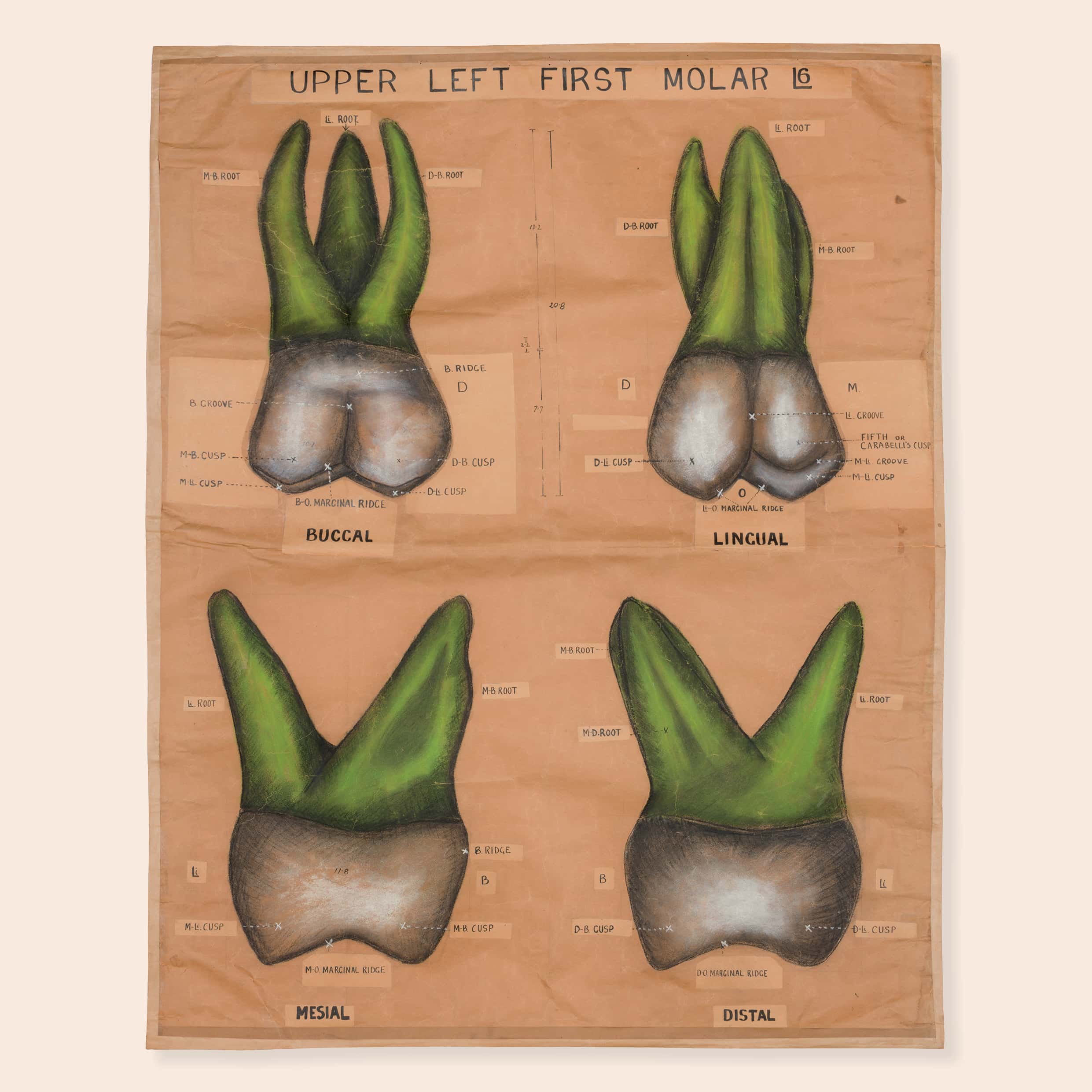  Charles Harold Down (1890–1965), ‘Upper left first molar L6’, from Cat. 112, Teaching aids: drawings, 1920–38, ink and pastel on paper, each sheet 117.0 × 90.0 cm. HFADM 1997, Henry Forman Atkinson Dental Museum, University of Melbourne. 
