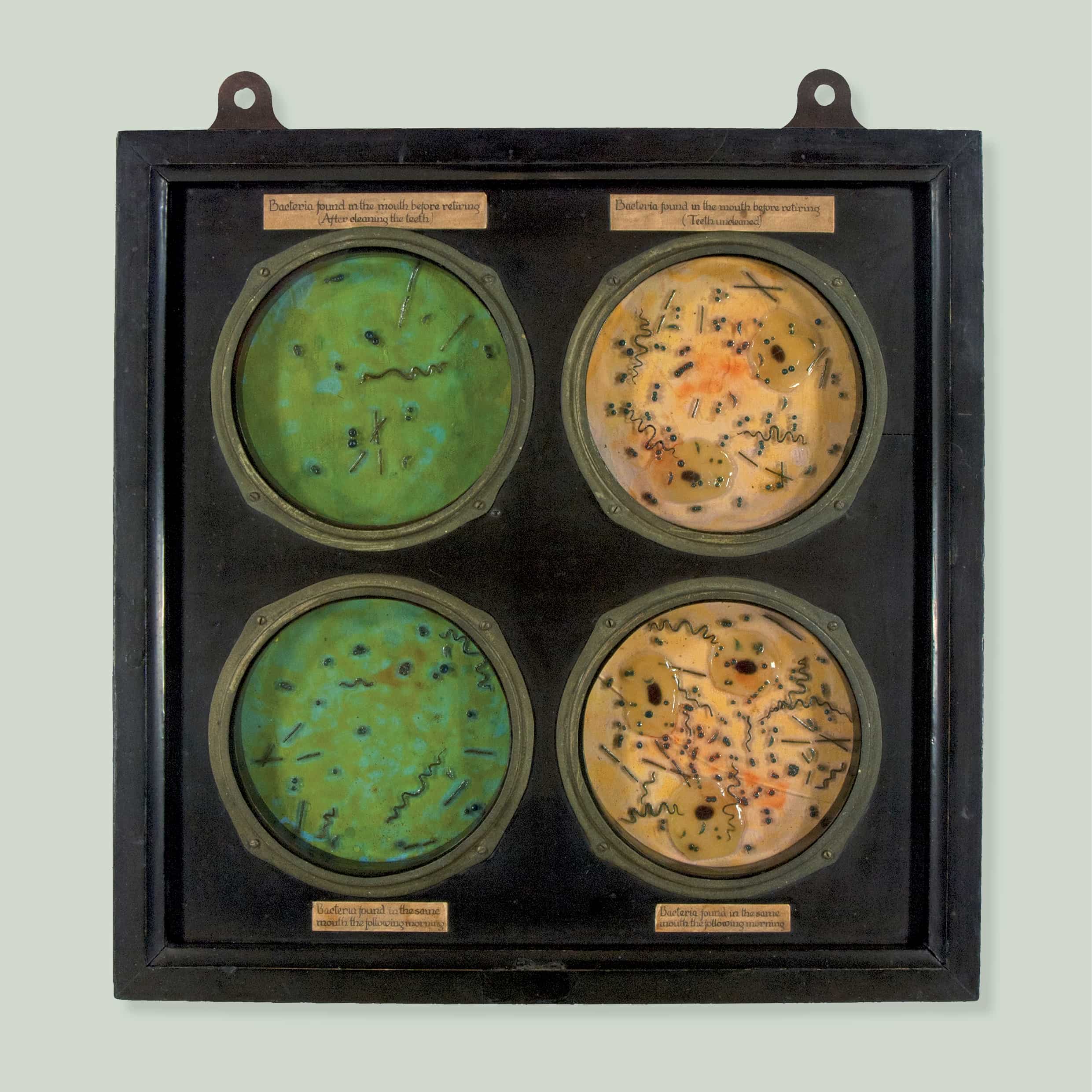 Model of oral bacteria in petri dishes, before and after cleaning teeth, c. 1905, wood, glass, metal, resin, paper; 37.5 × 37.5 × 3.5 cm. HFADM 1488, Henry Forman Atkinson Dental Museum, University of Melbourne.  